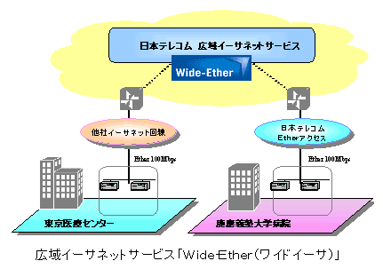 広域イーサネットサービス「Wide-Ether(ワイド・イーサ)」