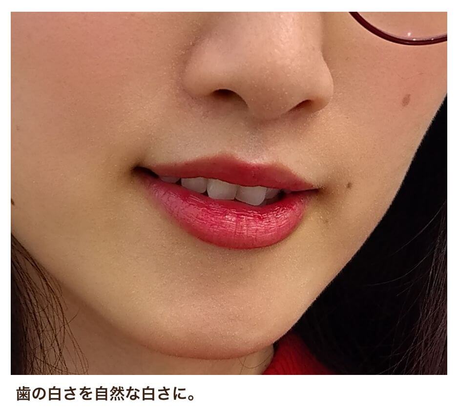口元 歯の白さを自然な白さに。